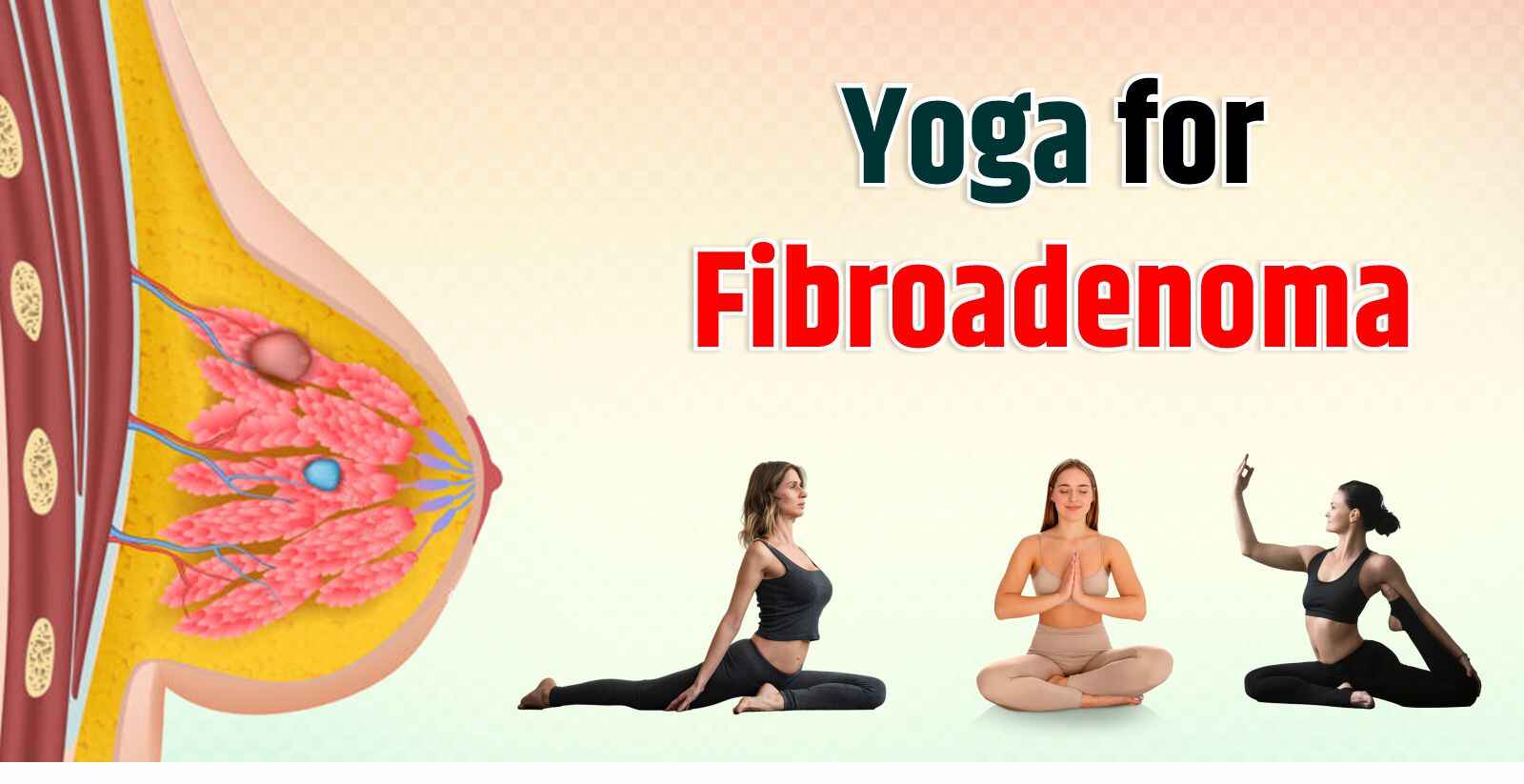 Yoga for Fibroadenoma